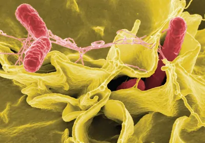 Salmonella (pink) invading a human epithelial cell (yellow)